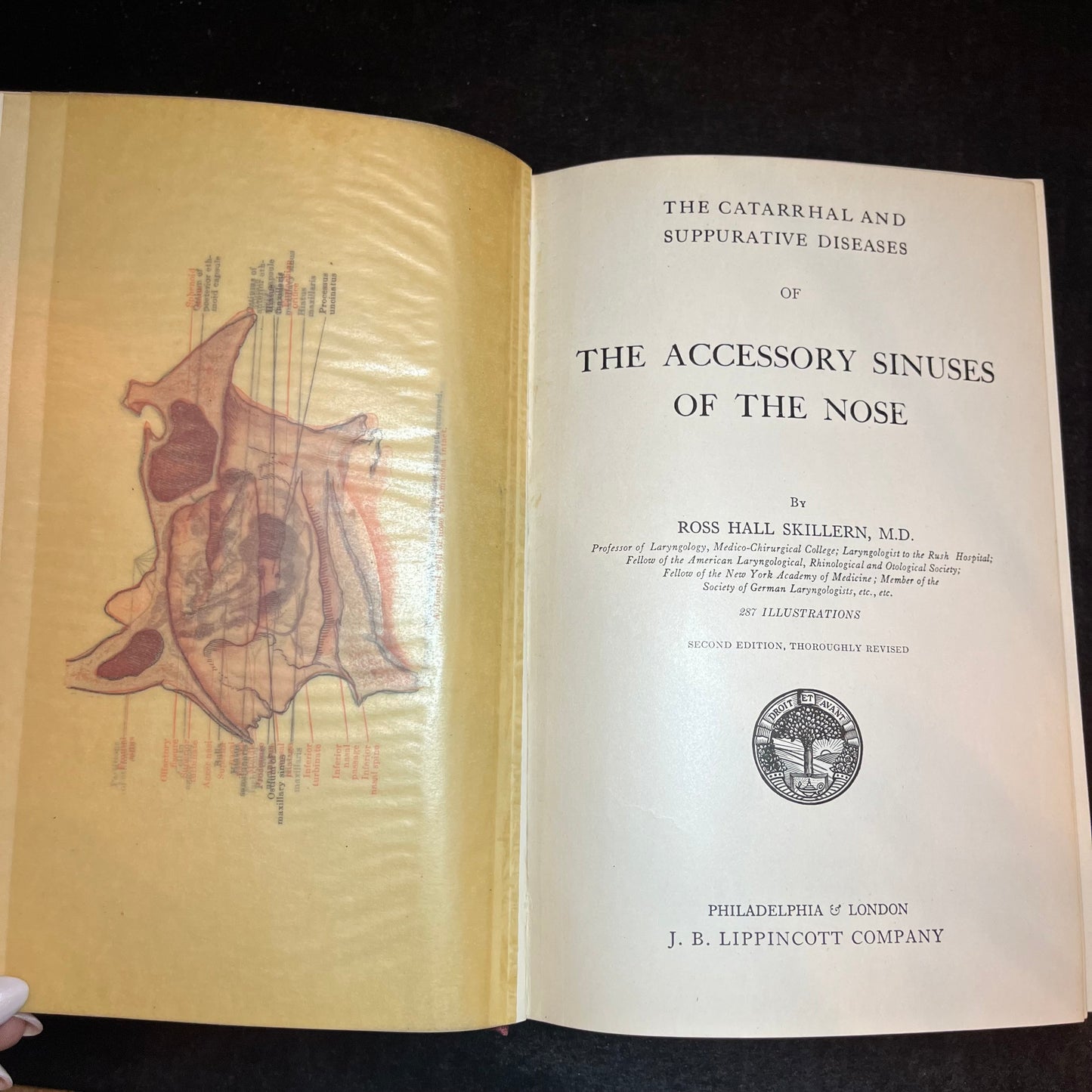 Accessory Sinuses of the Nose - Skillern - 1916