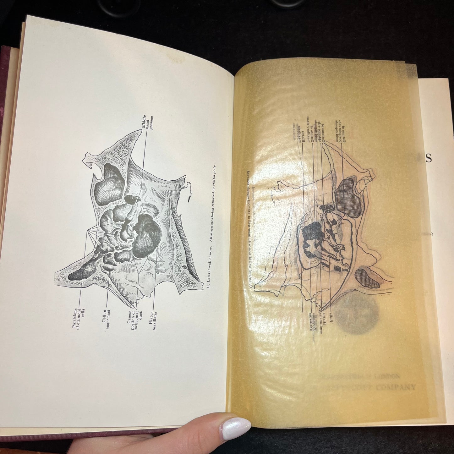 Accessory Sinuses of the Nose - Skillern - 1916