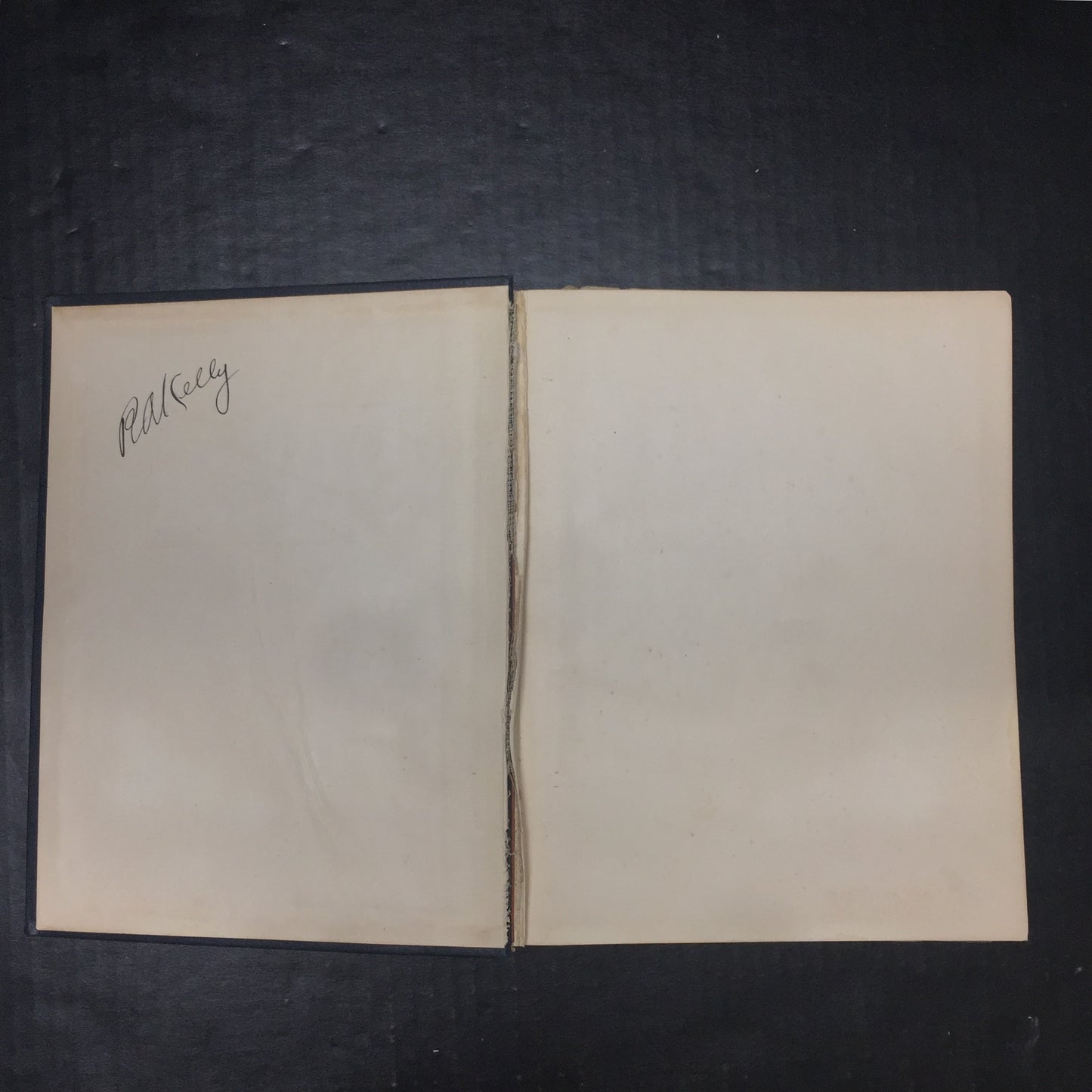 Photographs Of The Fundus Oculi Volume II - Arthur J. Bedell - Spine Separation - 1929