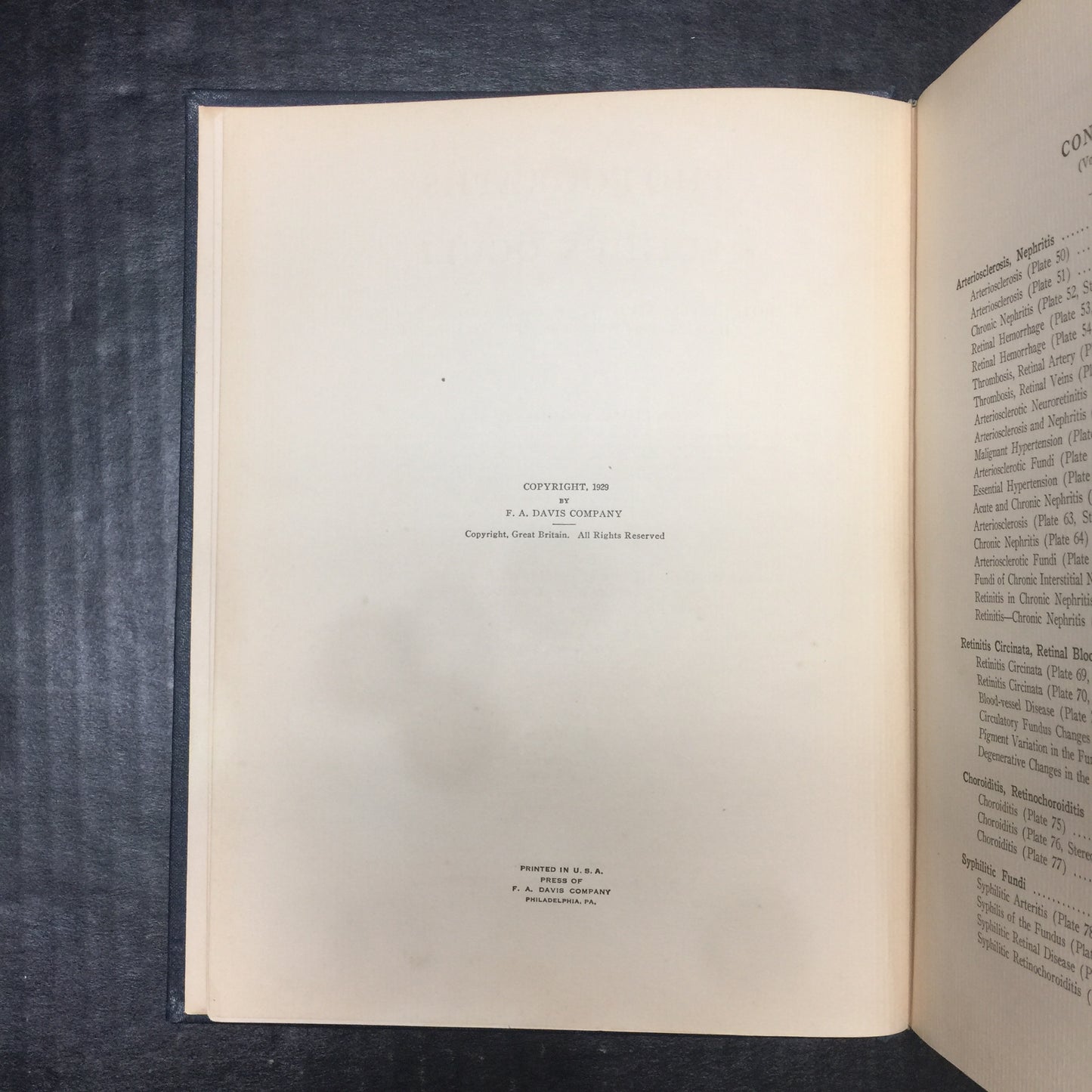 Photographs Of The Fundus Oculi Volume II - Arthur J. Bedell - Spine Separation - 1929