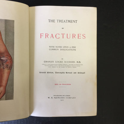 The Treatment of Fractures - Charles Locke Scudder - 1912