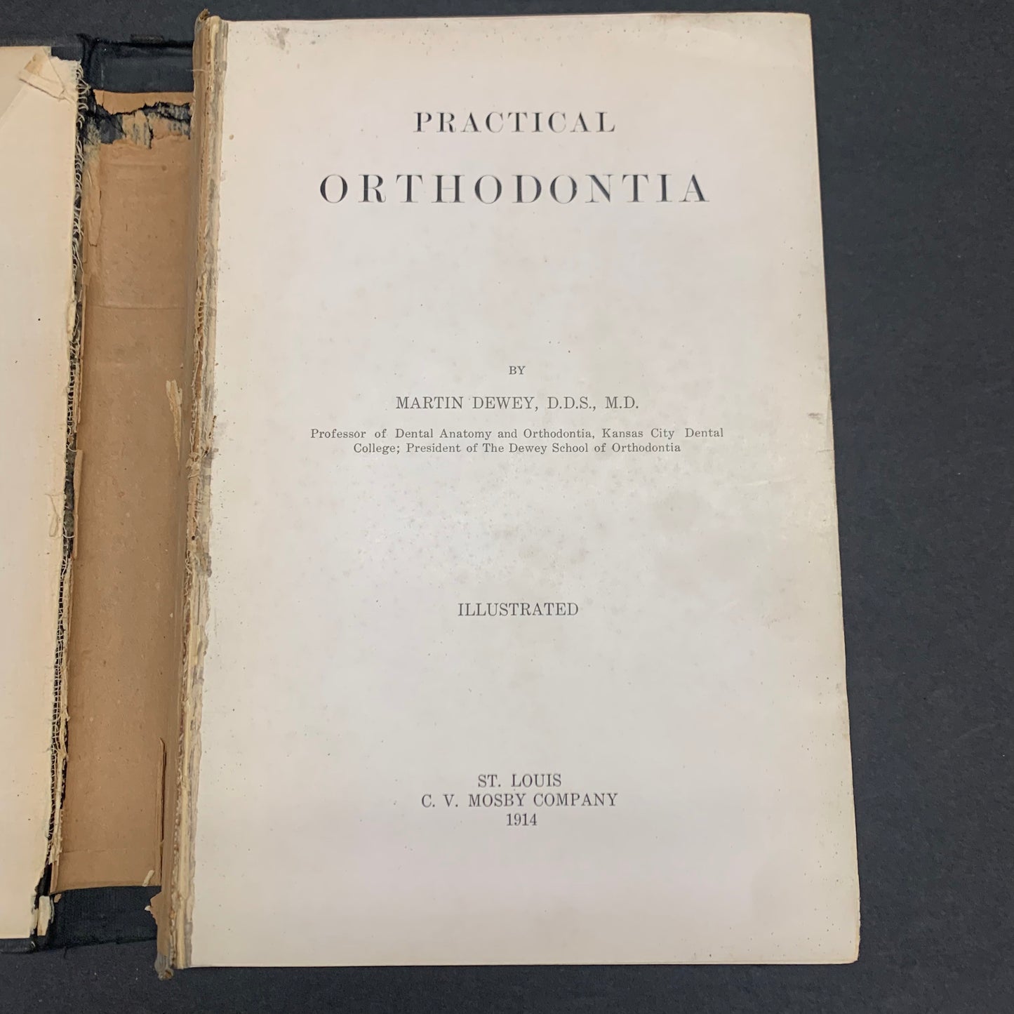 Practical Orthodontia - Martin Dewey - 1914